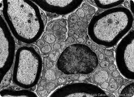 معرفی میکروسکوپ TEM)Transmission electron microscopy)