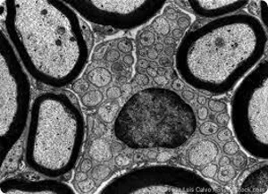 معرفی میکروسکوپ TEM)Transmission electron microscopy)